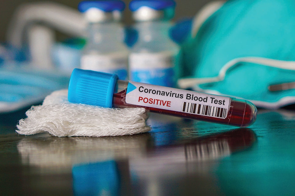 22770375_web1_Coronavirus-blood-test