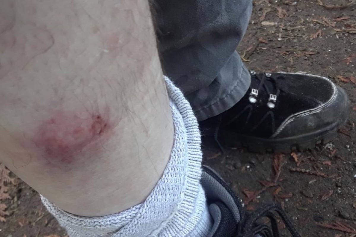 B.C. man recovering after bat bite, possible rabies exposure - The  Chilliwack Progress