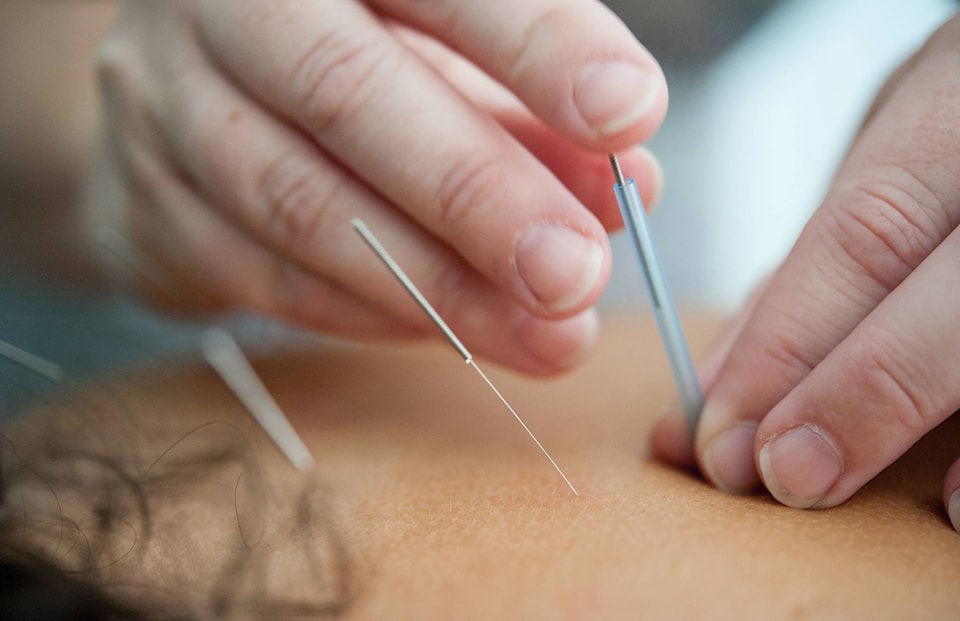 22574651_web1_200903-NTC-Clearwater-Acupuncture-pic1_1
