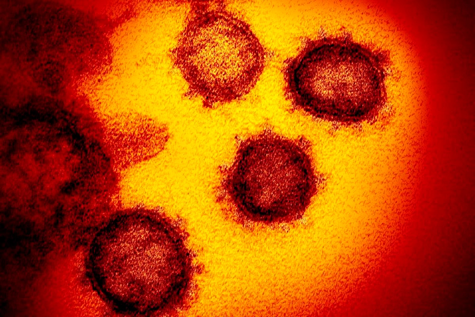 23340615_web1_Coronavirus-JUE-200303-Coronavirus_2