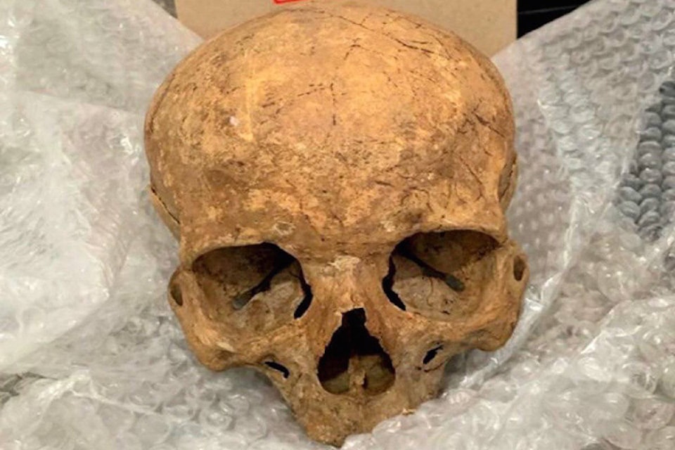 17577586_web1_Human-skull-copy