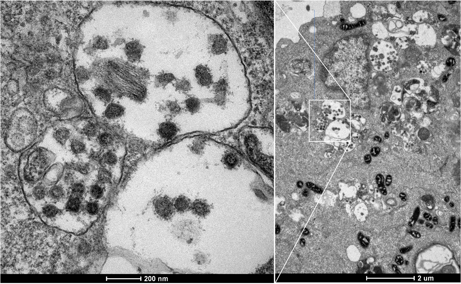 23599276_web1_201203-WIN-scientist-coronavirus_3