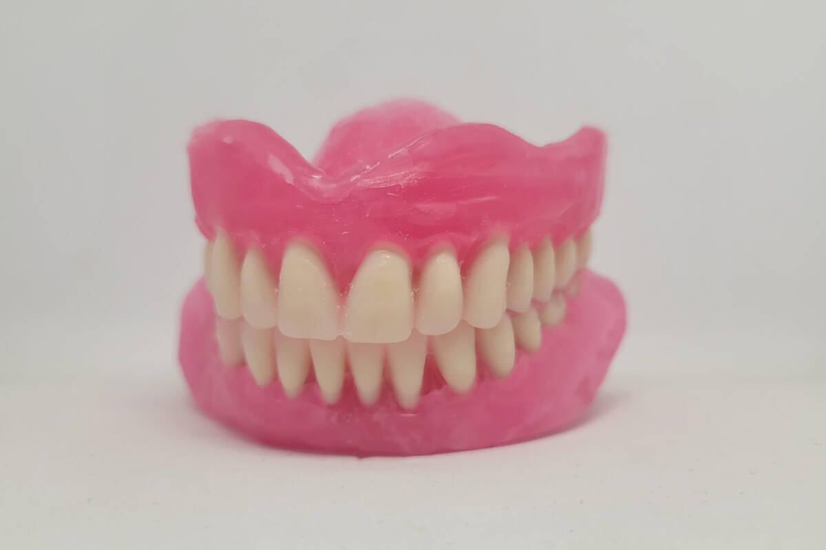 During your try-in appointment, the professionals at Kasper Denture Clinic will set your dentures in wax to try them on. This ensures you聮re happy with the shade before they set them in acrylic
