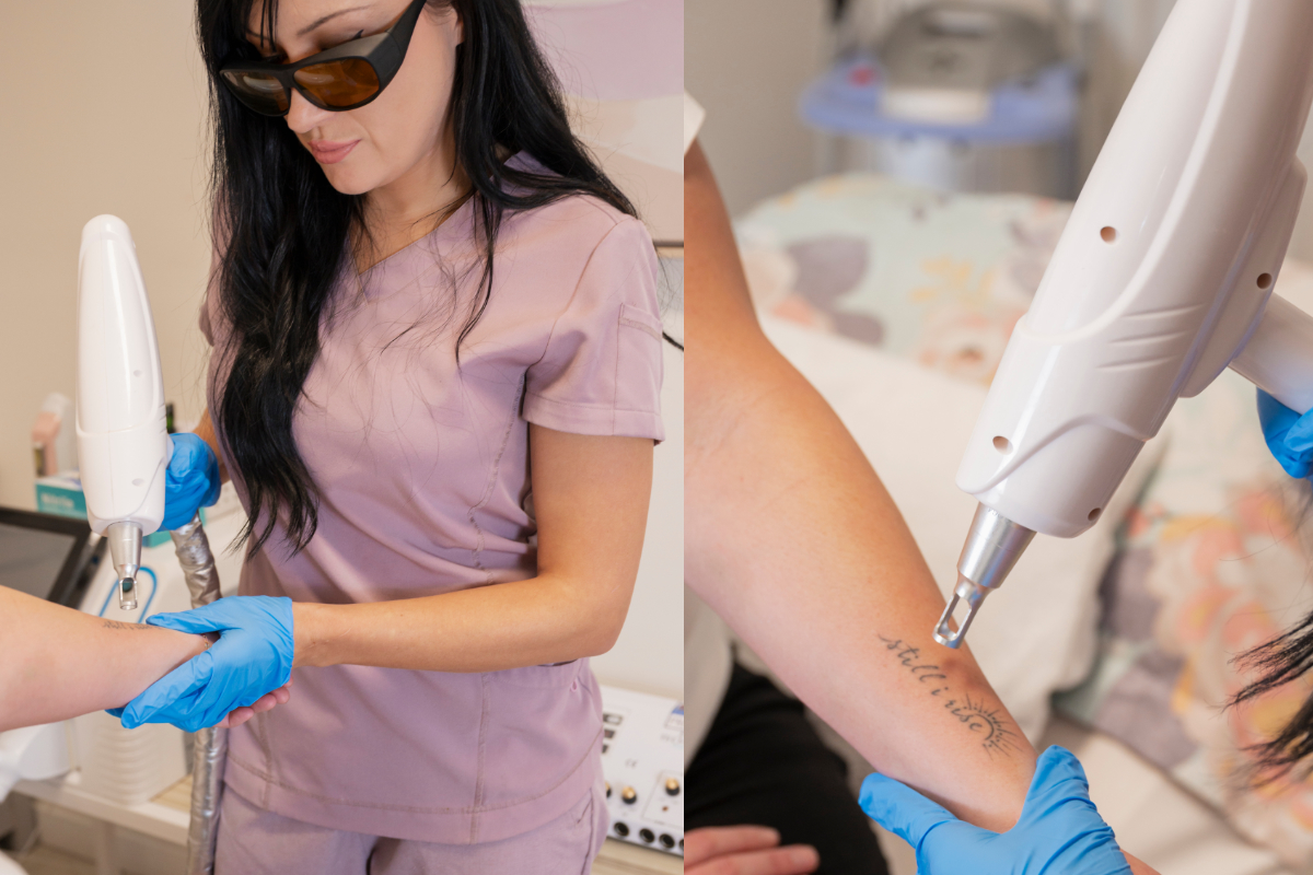 Ink free-dom: Island non-profit willing to remove gang tattoos for free