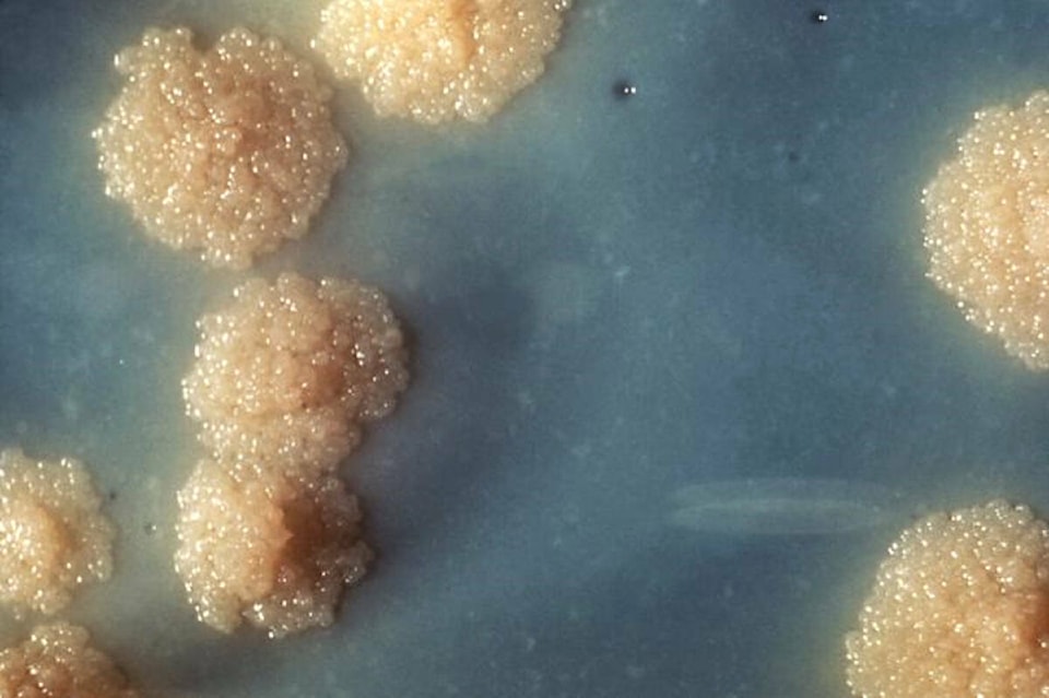 34428165_web1_231103-NUN-TB-Outbreak_1