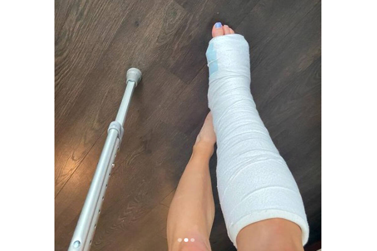 Georgia Ellenwood posted a photo of her injured leg after she suffered a ruptured Achilles tendon during a qualifying meet for the world pentahlon championships. (george_ahhh Instagram)