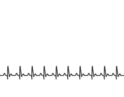 10587132_web1_180215-NTS-HeartBeatMetroGraphic