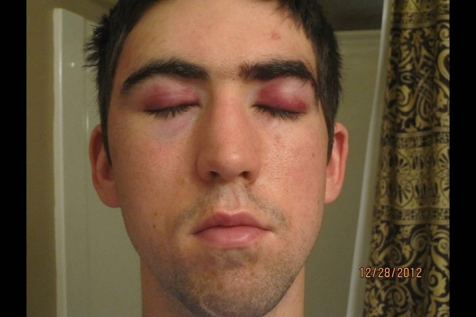 32359425_web1_230330-CCI-Brain-injury-victim-picture_1