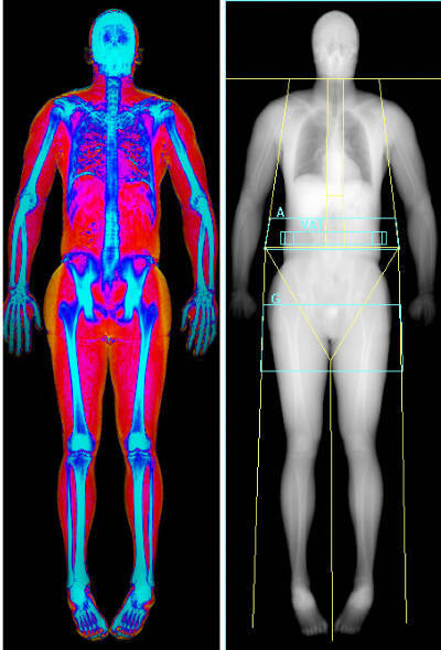 DEXA scans by Bodycomp Imaging give an in-depth look at your body composition.