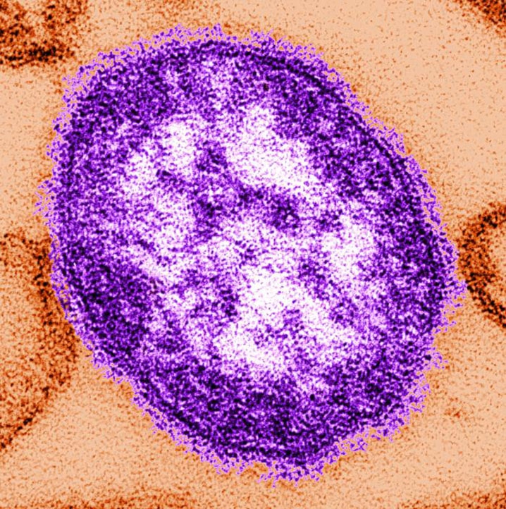 WEB-Measles-Virus