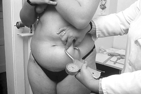 c05-obese-woman