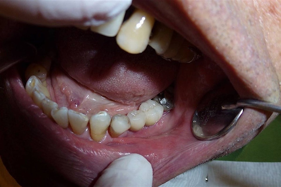 20975196_web1_20190411-BPD-Implant-dentistry-picryl.com
