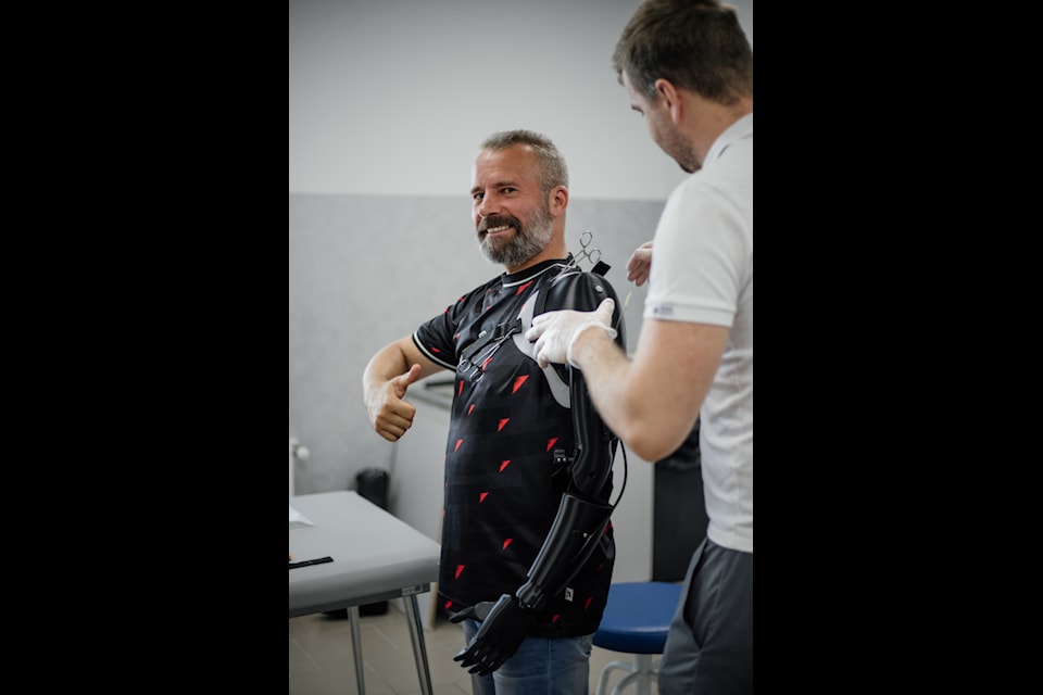 More than 140 amputees live better lives thanks to the clinic set up in Ukraine by the Victoria Hand Project during a trip there two years ago.