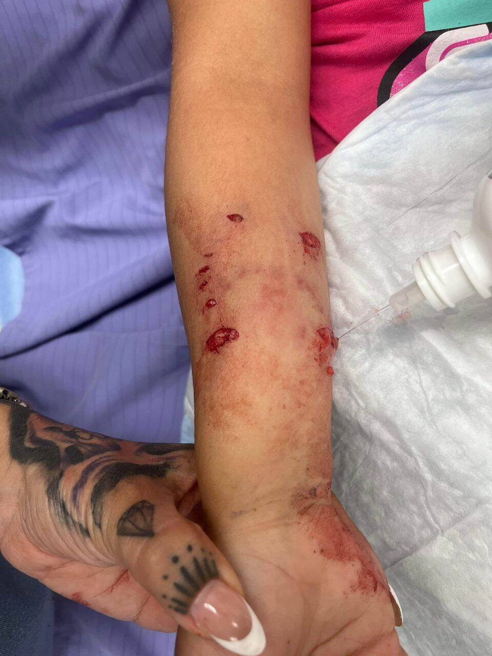 Young girl rushed to Princeton hospital following dog attack - Salmon Arm  Observer