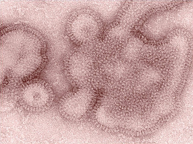 web1_s-h3n2-influenza-virus-edh-190322