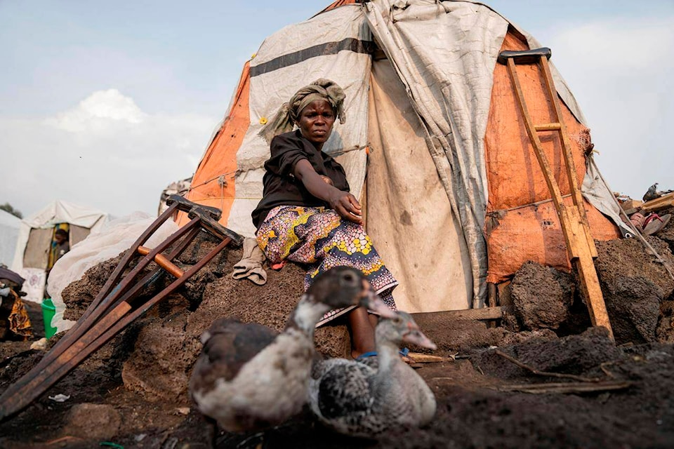 Sarah Bagheni, in the Bulengo refugee camp in Goma, Congo, suspects she may be infected with Mpox after the World Health Organization had declared Thursday, Aug, 15, 2024, the increasing spread of mpox in Africa a global health emergency, warning the virus might ultimately spill across international borders. (AP Photo/Moses Sawasawa) 