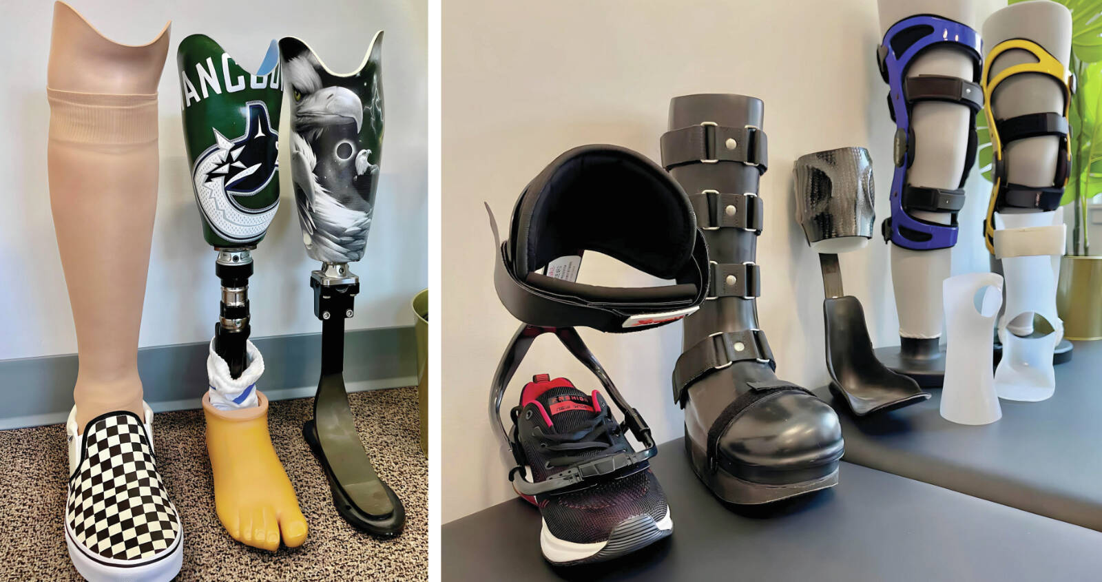 Left: A selection of customized cosmetic designs that Pentlands patients have picked for their finished prosthesis. Right: Patients have the option to customize the cosmetic design of their orthoses.