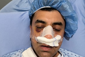 Terrace businessman faces painful recovery following assault