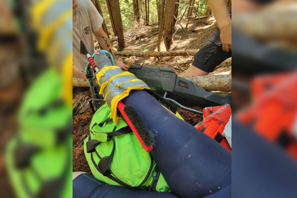 The woman's leg splinted with two snow brushes. (Contributed by Bri McQuair)