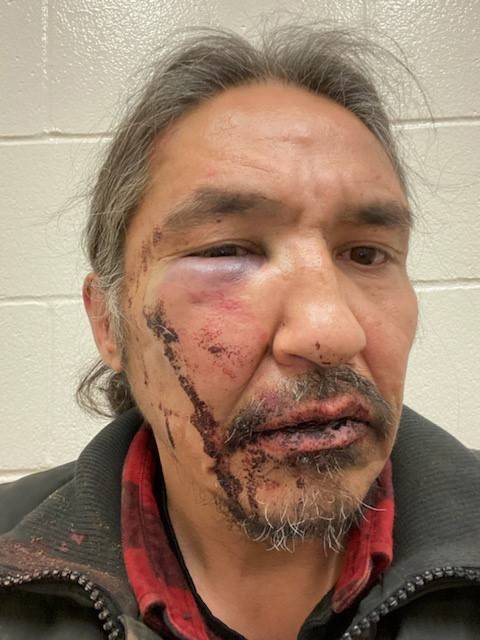 Athabasca Chipewayan Chief Allan Adam is shown in a handout photo. The chief of a northern Alberta First Nation is calling for the government to investigate after he alleges RCMP assaulted him during an arrest that he says began over a simple matter of expired registration tags on his truck. THE CANADIAN PRESS/HO-Allan Adam MANDATORY CREDIT